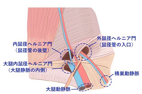 水戸 鼠径部|鼠径ヘルニア（外鼠径ヘルニア、内鼠径ヘルニア、大。